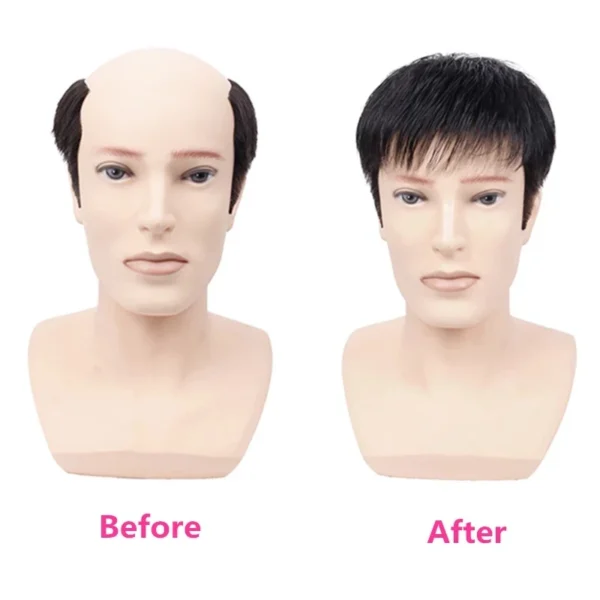 Wigs for Men: Thick Human Hair Toupee, PU Hair Replacement System - Image 5